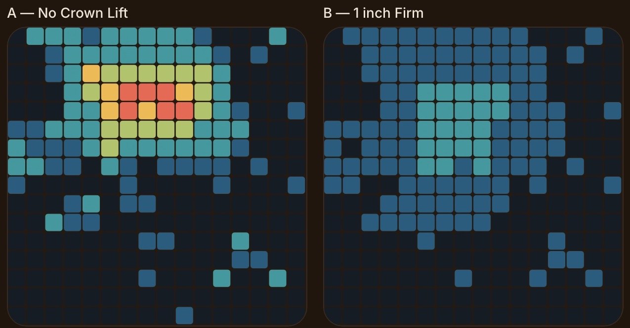 Real pillow map: on the left a tight red hot spot with no Crown Lift®; on the right, with a 1 inch firm insert, the contact spreads out in cooler colors.