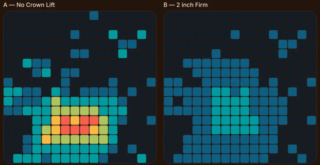 Real Pillow Mapping comparison: No Crown Lift® vs. 2 inch Firm insert. The concentrated hot spot on the left is gone on the right. The same head is now spread across a broader area in cooler colors — far less contact piling up in one place.